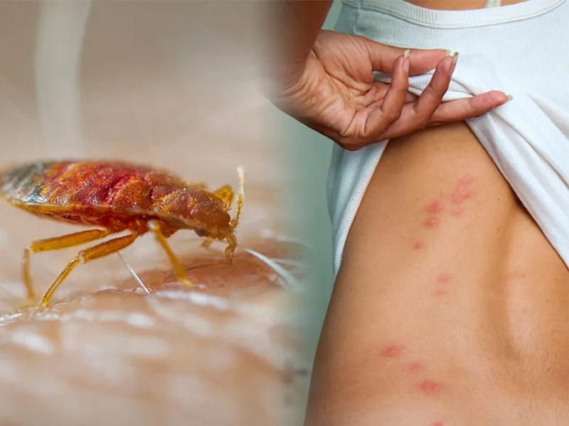 Bed Bug Control Service